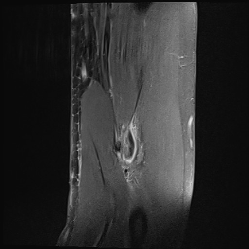 Click on the Serie image to view the images of Wieszt, Gnter